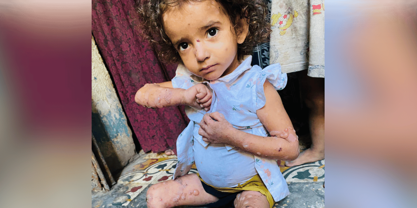 Help for Sand and her family in Gaza
