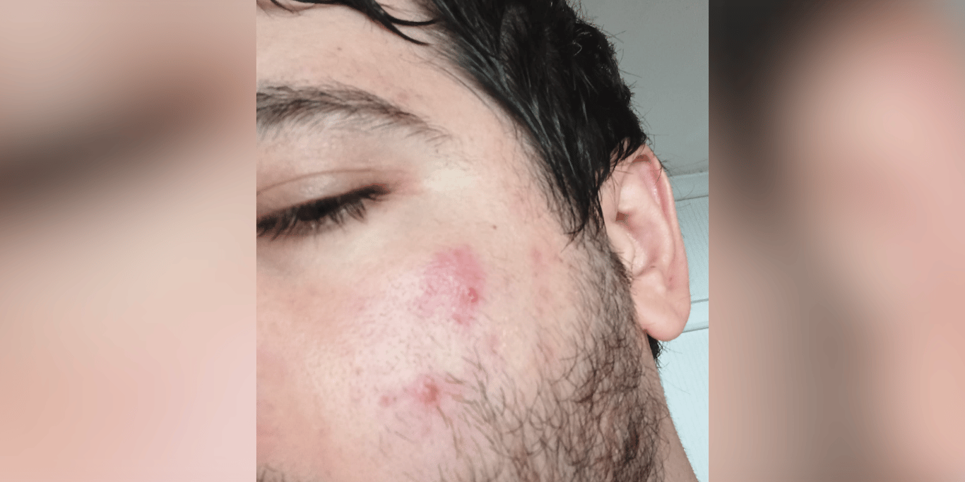 Help Me Afford the Medical Treatment I Need and Start Over