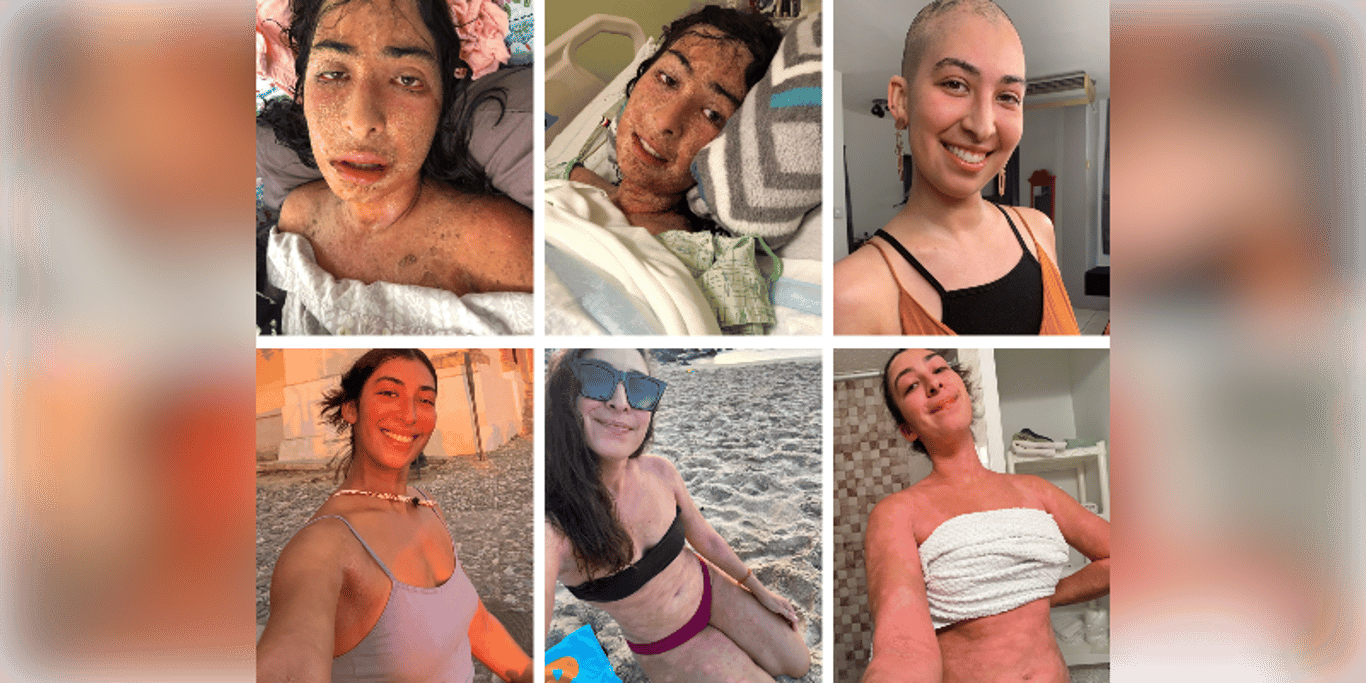 Help me heal my skin condition and gain back my life and freedom