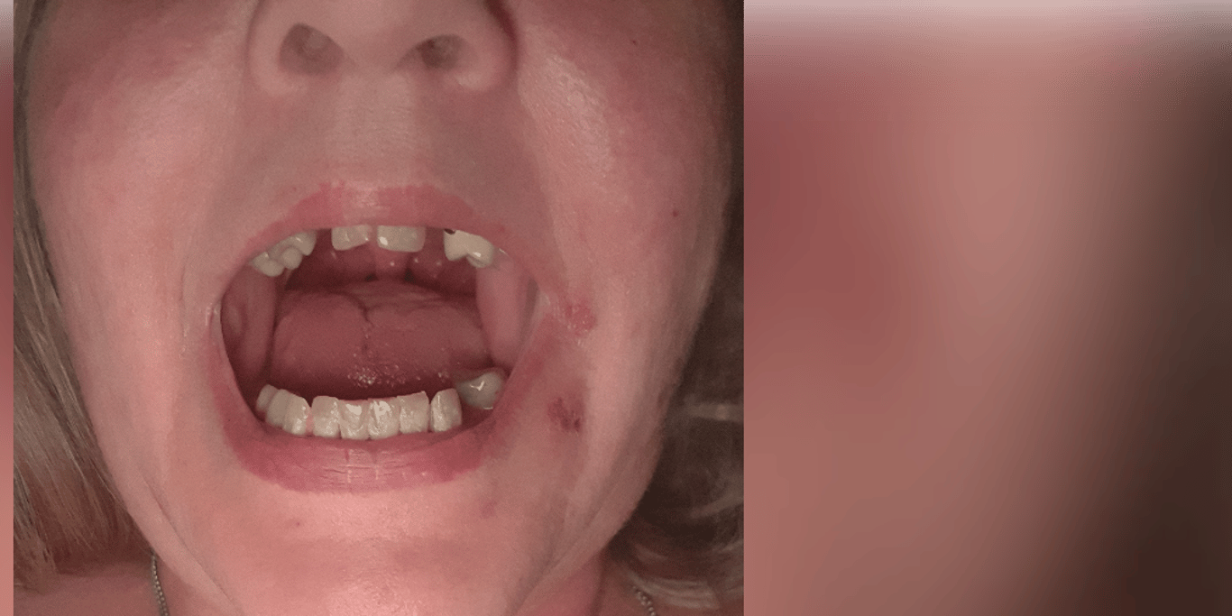 Two Surgeries