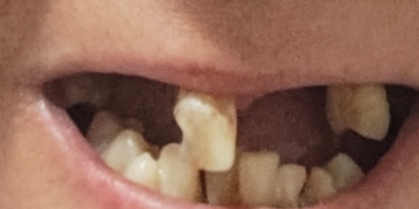 Donativo para ajuda de dentes