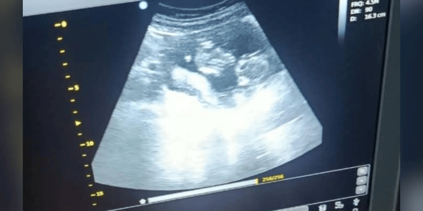 Help Haya and Shaker for Their Upcoming Baby