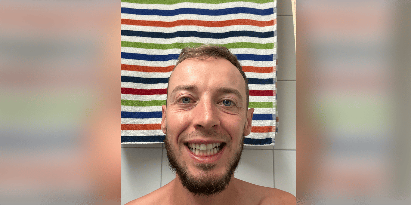 Dysgnathie (bimaxillär) Korrektur
