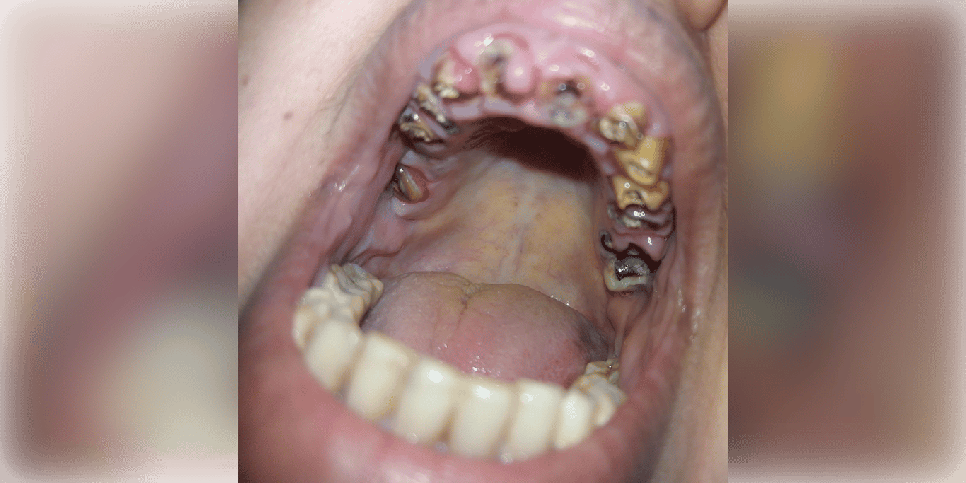 🌿 Humanitarian Appeal – Urgent Dental Care Needed