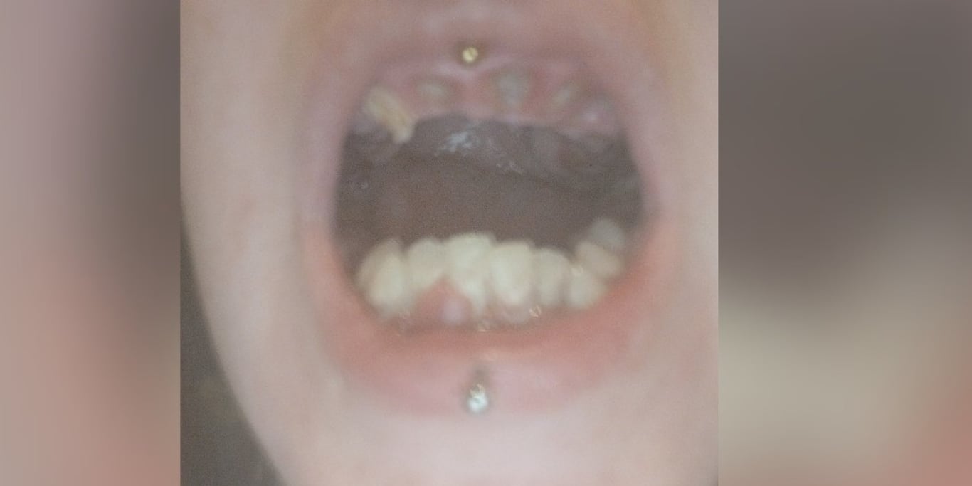 Please help me smile finally