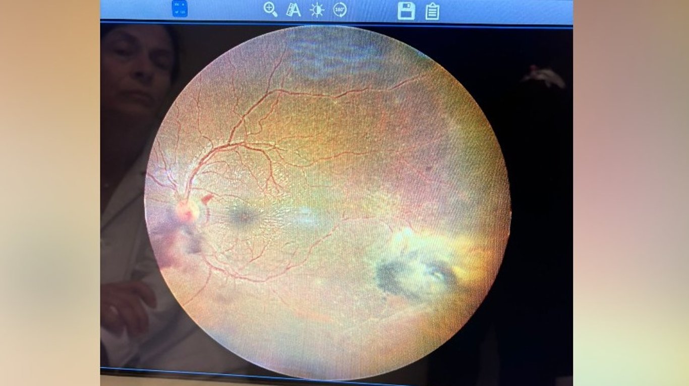Help Me Save My Sight: An Urgent Fight to Get the Eye Surgery I Need