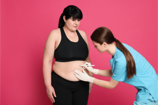 Weight Loss Surgery Cost