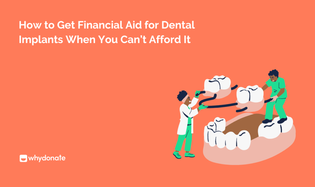 How to Get Financial Aid for Dental Implants When You Can’t Afford It